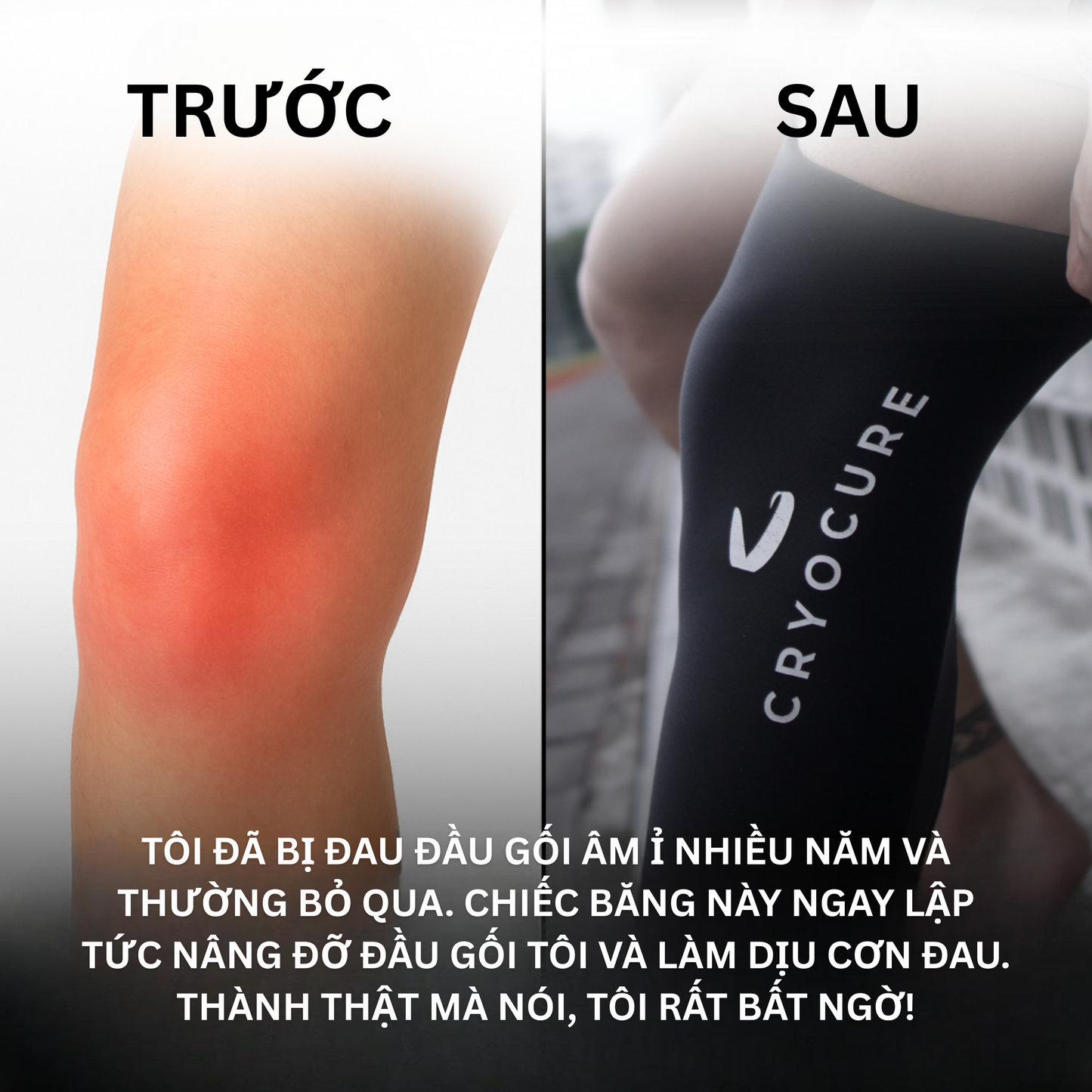 Cryocure - Bó Gối & Bó Tay Đa Năng (COD)